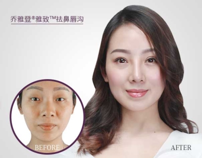 乔雅登前后对比图